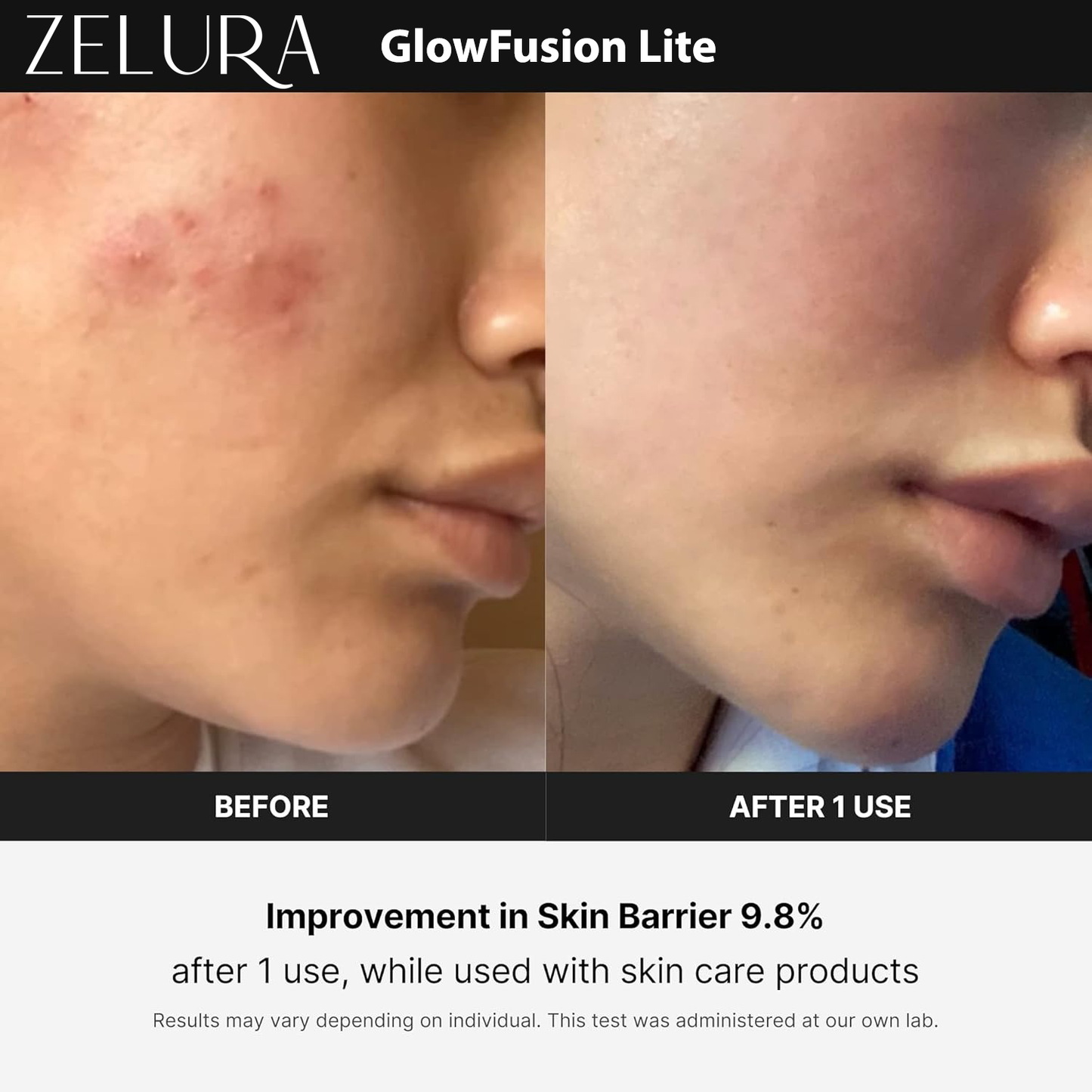 Zelura Nova Glow Lite | Your Skincare, Supercharged