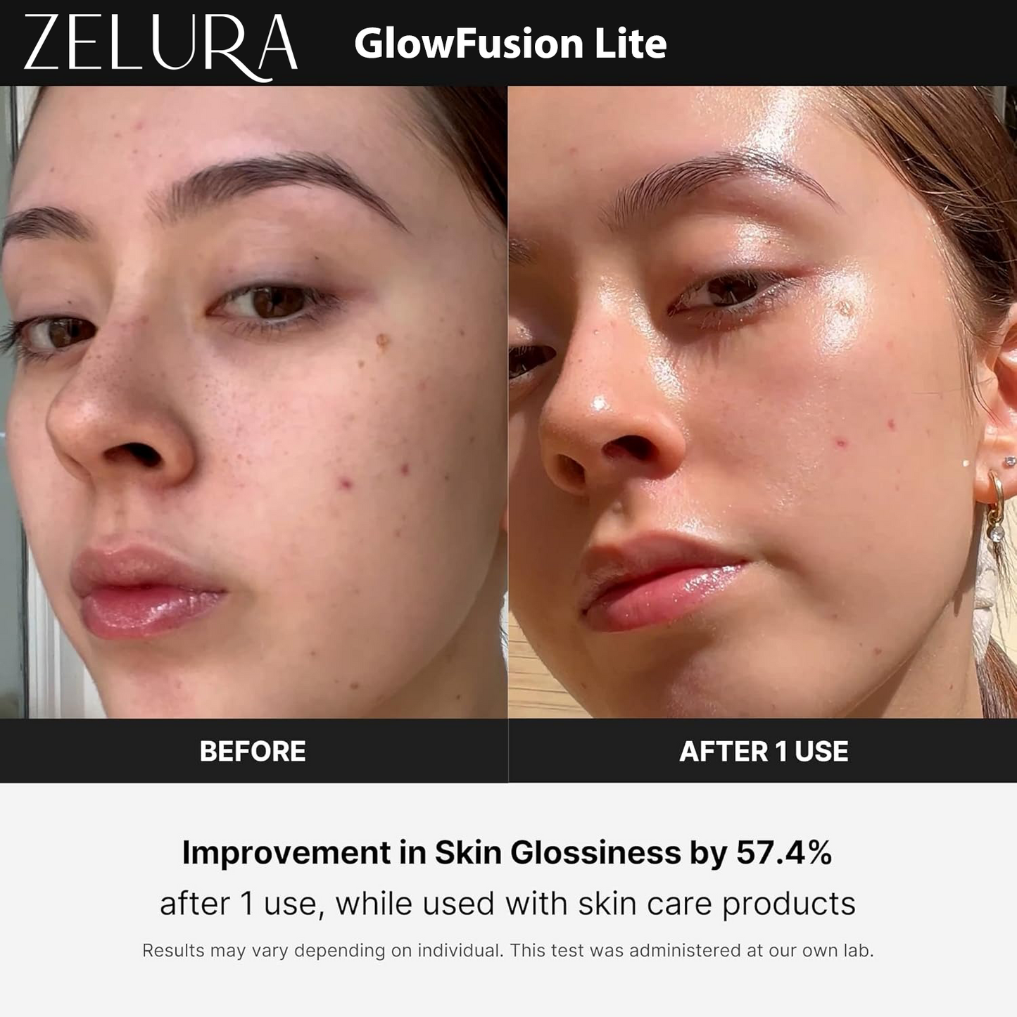 Zelura Nova Glow Lite | Your Skincare, Supercharged