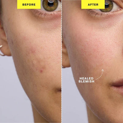 Zelura Nova Glow Pro | 6-in-1 LED Skin Perfector
