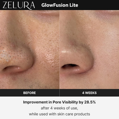 Zelura Nova Glow Lite | Your Skincare, Supercharged